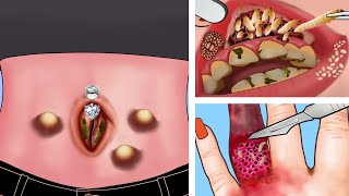 ASMR The best treatment of clean navel piercings , clean up between teeth due to food clinging