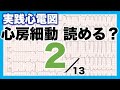 【心電図 読み方 ②】心房細動