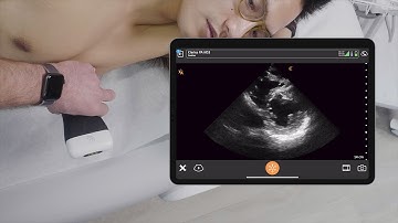 Parasternal Short Axis Cardiac View