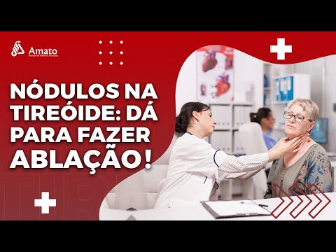 Vídeo: Quando foi inventada a ablação por radiofrequência?