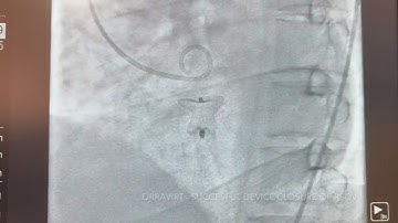 DRRAVIRT   RSOV DEVICE CLOSURE