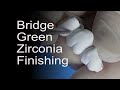 Aesthetic CEREC Zirconia Bridge Workflow