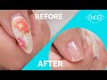 Remove Acrylics Using Your Opposite Hand