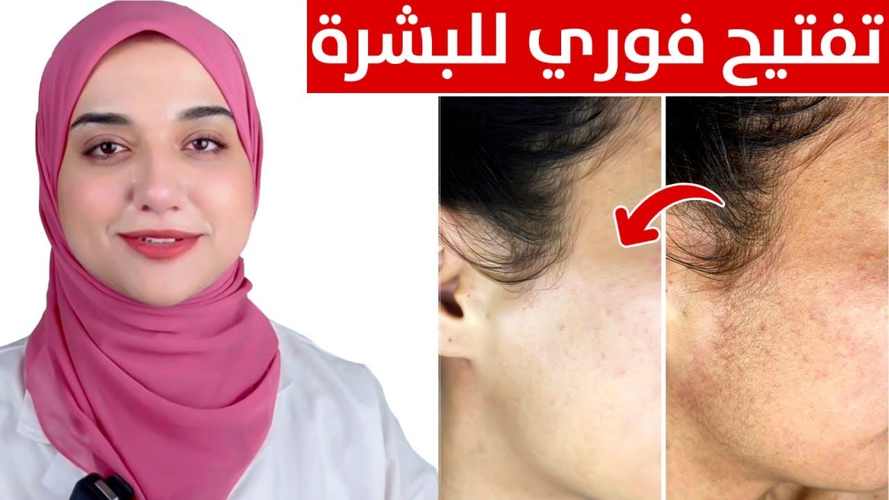 تفتيح فورى و نضارة البشرة في دقايق /تقشير آمن للبشرة في المنزل