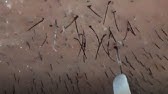 Plucking Facial Hair 髭抜き中に白いヒゲ発見 毛根は何色 Youtube Plucking Facial Hair 髭抜き中に白いヒゲ発見 毛根は何色 Youtube