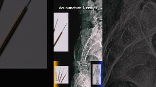Acupuncture needles on X-Ray #shorts #xray #acupuncture
