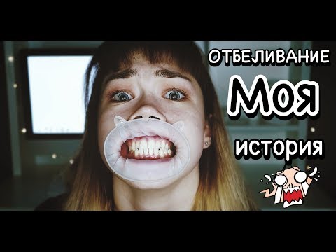 ОТБЕЛИВАНИЕ ЗУБОВ  МОЯ ИСТОРИЯ  ПЛЮСЫ И МИНУСЫ ОТБЕЛИВАНИЯ