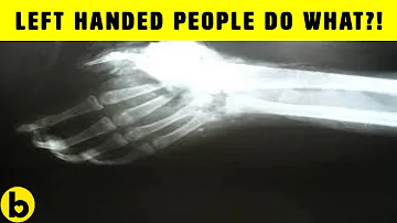 Is being left-handed uncommon?