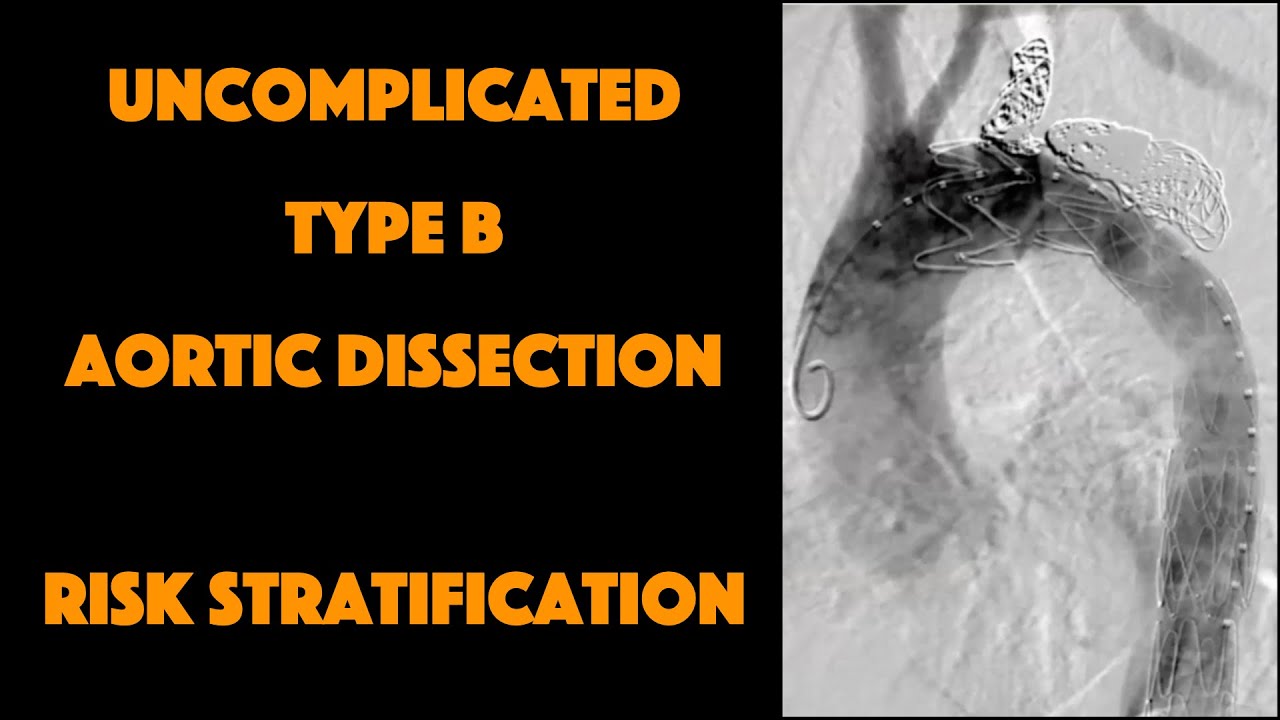 Uncomplicated Type B Aortic Dissection: Part 3 Risk Stratification