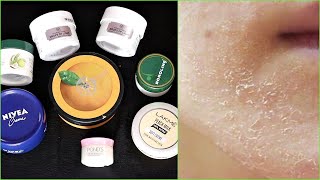 DRY / ROUGH skin के लिये सबसे अच्छा  Moisturiser कौन सा हैं ?? Top 7 Daily Face Cream #skincare#HACK