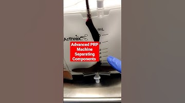 Advanced PRP Machine Separating Components ..Dr Sai Chandra