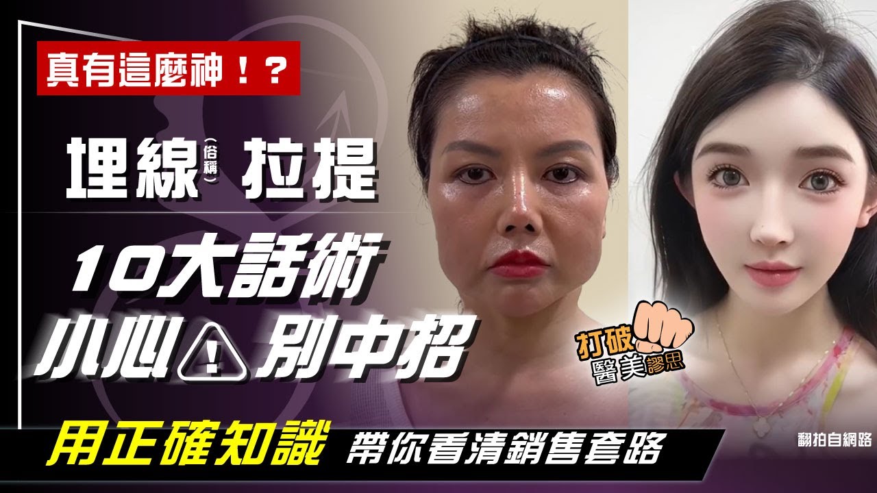 埋線(俗稱)拉提真有這麼神！？　線雕拉提10大話術　你聽過哪幾種？ 打破醫美謬思 311-20240109