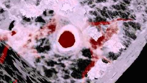 Micro-CT visualisation of small airway and blood vessels in lung