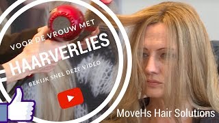 De Crownextension voor de vrouw met haarverlies bovenop het hoofd.