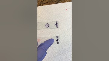 Lab Exercise 5: Bacterial Morphology and Staining Techniques (Exercise 1)