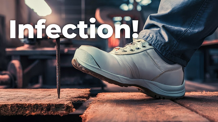Why is it so dangerous to step on a rusty nail -- Find out now!