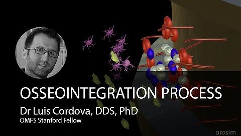 1-Minute 3D Guide to Osseointegration