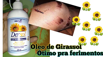 Pode colocar óleo de girassol em feridas?