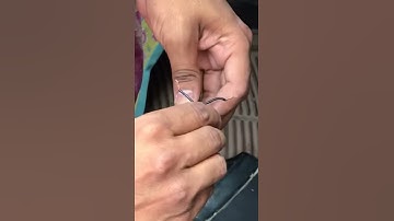 Sfari remot matching