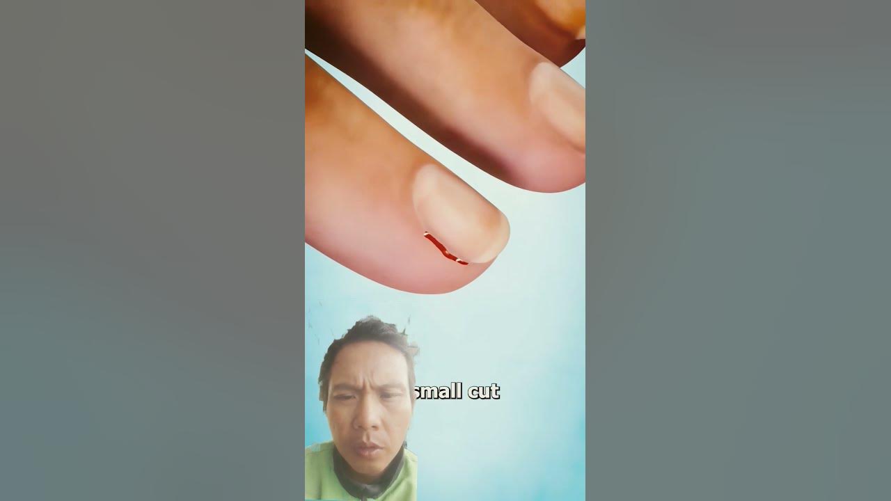 Why you shouldn't peel your hangnails 😬 Why you shouldn't peel your hangnails 😬