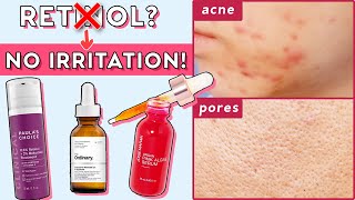 How to Use Retinol & Retinoids For Sensitive Skin + Beginners!