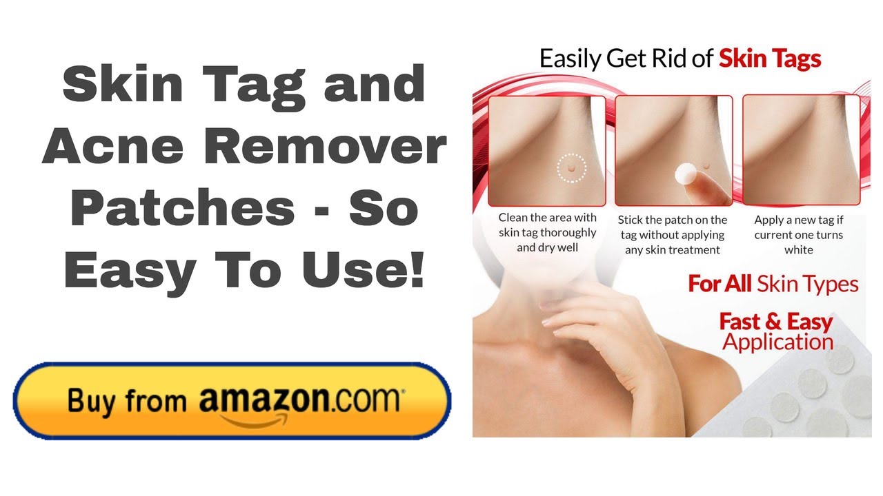 Skin Tag And Acne Remover Patches So Easy To Use YouTube