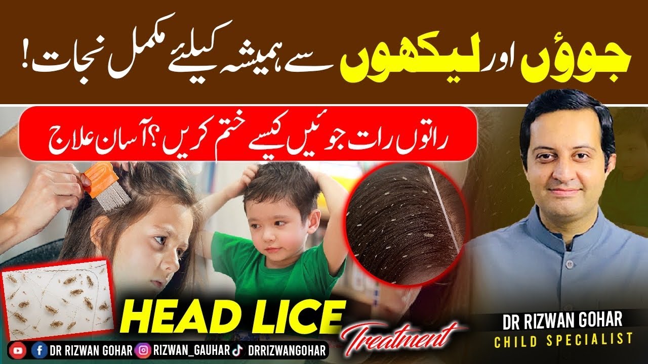 Say Bye Bye Forever to Head Lice  lice  treatment