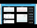 Upgraded - Arrhythmia Recognition and Classification Using KNN - Digital Signal Processing | MATLAB