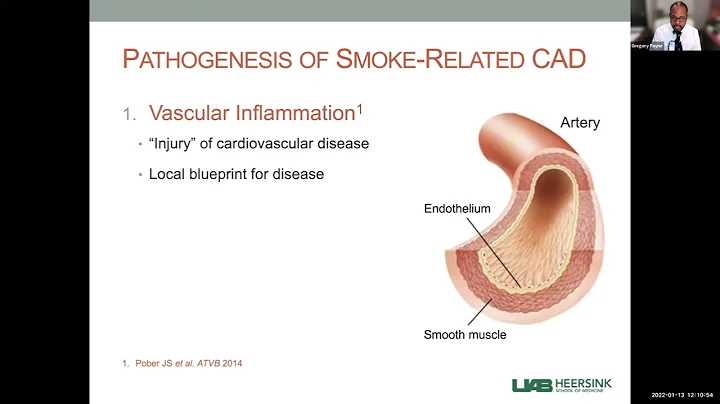 "Matrikines and Smoke-induced Atherosclerosis" - G...