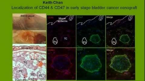 Spotlight on Basic Stem Cell Research - Irv Weissman
