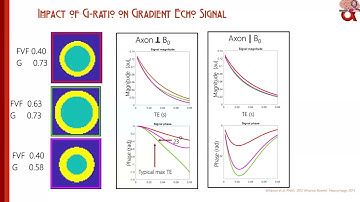 OHBM 2022 | 254 | Symposium | Jose P. Marques | Decoding MR g-ratio by integrating generative Biop…
