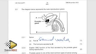 REPRODUCTION & REFLEX ARC: QUESTIONS: LIFE SCIENCE PAPER 1 GRADE 12 FINAL EXAMS :THUNDEREDUC M.SAIDI