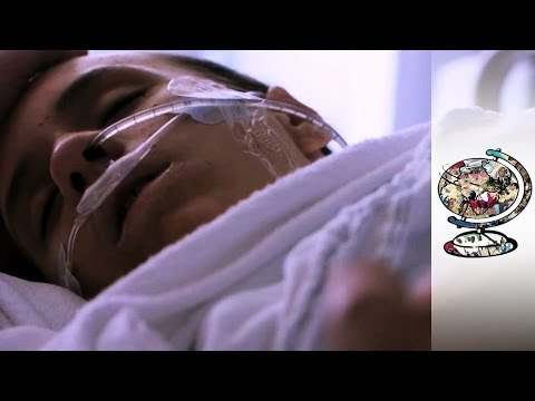 Treating The Most Severe Cases Of Tourette's Syndrome