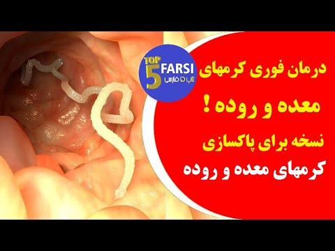 تصویری: آیا کرم های مومی می توانند گاز بگیرند؟