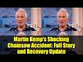 Martin Kemp's Shocking Chainsaw Accident: Full Story and Recovery Update