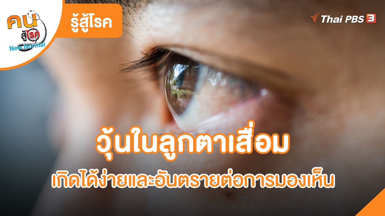 วุ้นในลูกตาเสื่อม เกิดได้ง่ายและอันตรายต่อการมองเห็น | รู้สู้โรค - YouTube
