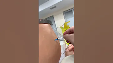 ضرب إبرة العضله 