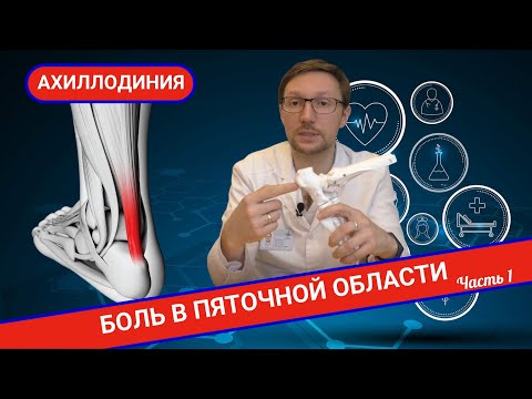 ПОЧЕМУ БОЛИТ В ОБЛАСТИ ПЯТКИ? АХИЛЛОДИНИЯ. (Часть 1)