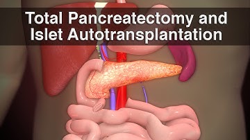 What is TPIAT? | Medical Animation | Cincinnati Children