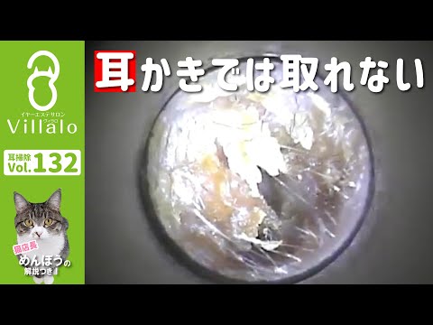 耳掃除動画vol.132「耳かきでは取れない」