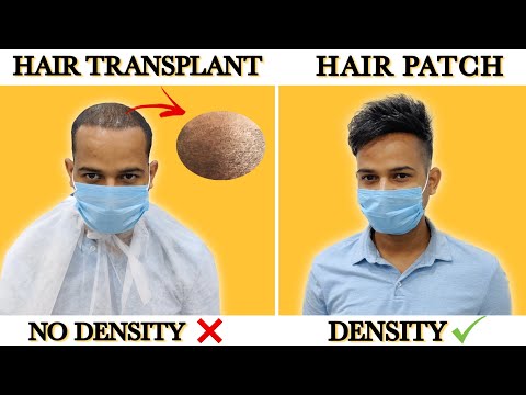 Hair Wigs in Delhi | Hair Patch in Delhi | Malhotra Hair Replacement