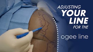 Reshaping Your Curves with Ogee LIPO and FAT Transfer