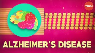 What Is Alzheimer's Disease? - Ivan Seah Yu Jun