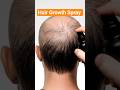 #longhairgrowthtips #beautytips #hair #hairstyle #haircut #hairgrowth