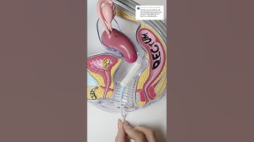 Tampon placement vs menstrual cup vs menstrual disc shown in models #shorts