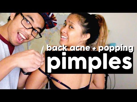 BABY GOT BACK-ACNE + POPPING HER PIMPLE | RACHEYandMARK