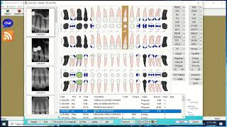 How to Walk Out Treatment in Eaglesoft