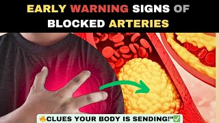 9 Silent signs Of blocked artery You Need To Know ll Artery Blockages Sign You Should Never gnore