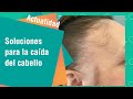 Soluciones naturales para la caída del cabello | Actualidad