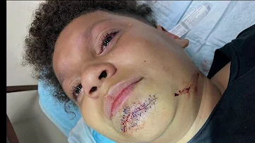 Mom fights to protect son after brutal attack at Campbell Middle School